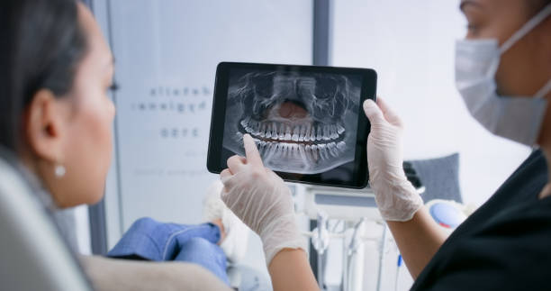 Licensed Teeth Whitening service in Port Dickinson, NY - Smile Center Dentistry